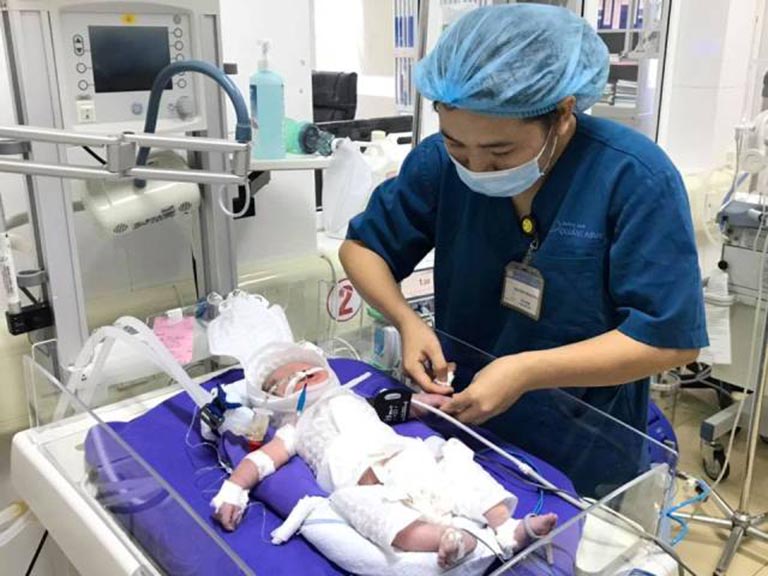 trẻ sơ sinh ảnh hưởng não từ việc rung lắc bé