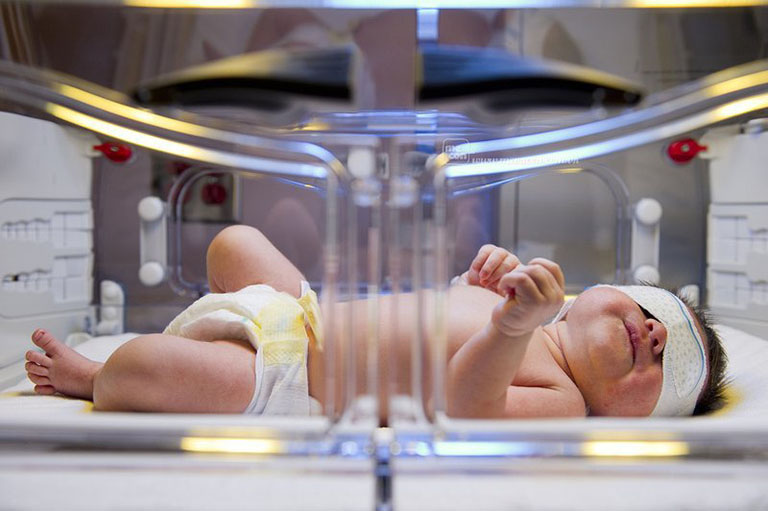 trẻ sơ sinh ảnh hưởng não từ việc rung lắc bé